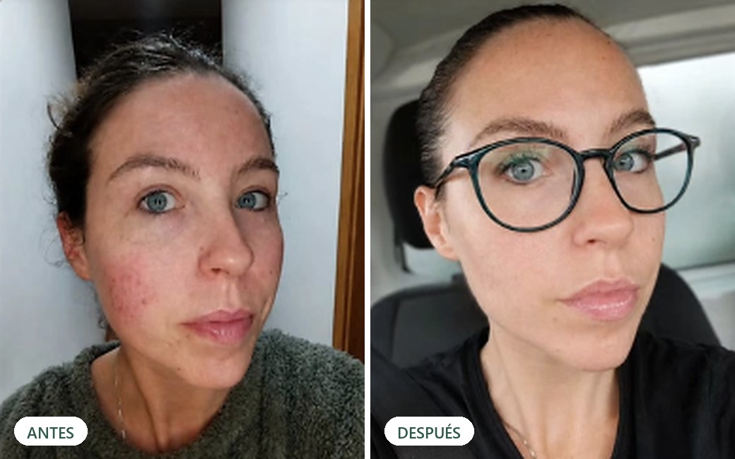 Resultado real de una clienta: antes y después